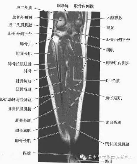 小腿部断层解剖+详细标注