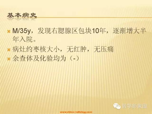 【病例】腮腺肌上皮瘤1例CT影像表现