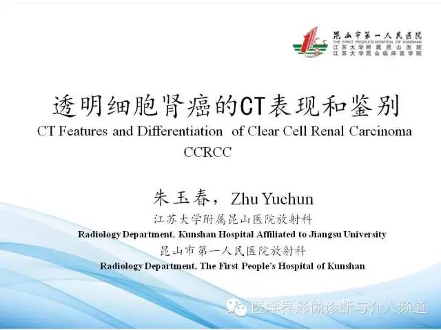 【PPT】肾透明细胞癌的CT表现和鉴别