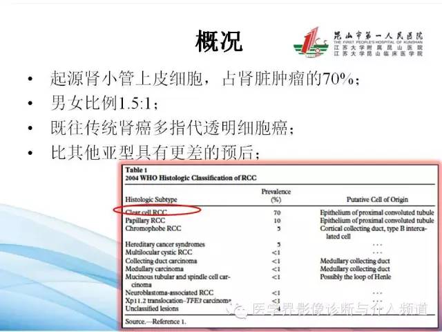 【PPT】肾透明细胞癌的CT表现和鉴别
