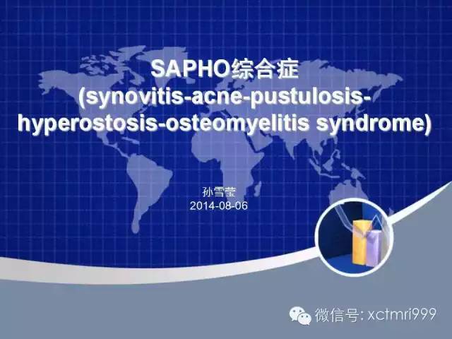 SAPHO综合征