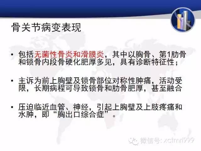 SAPHO综合征 SAPHO综合征