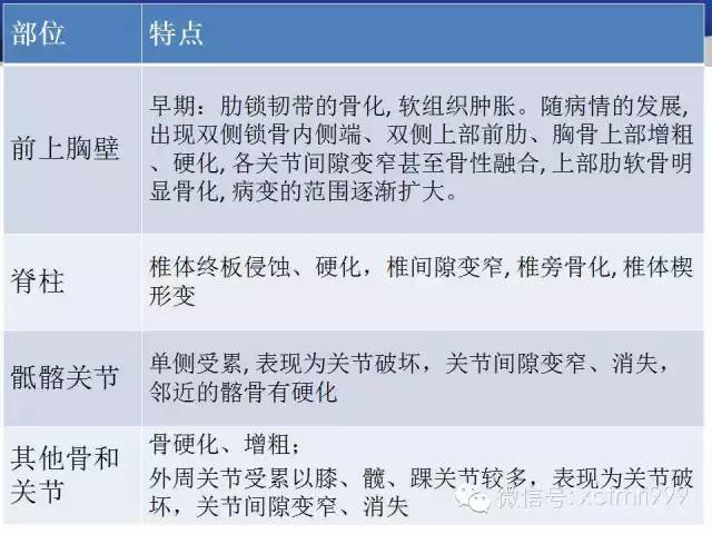 SAPHO综合征 SAPHO综合征