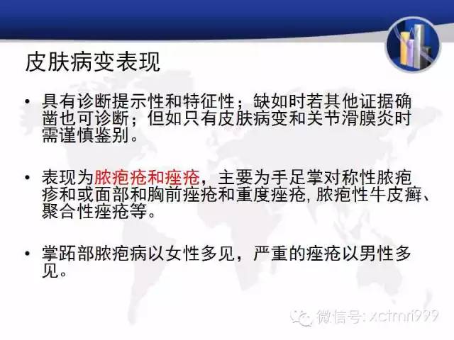 SAPHO综合征 SAPHO综合征