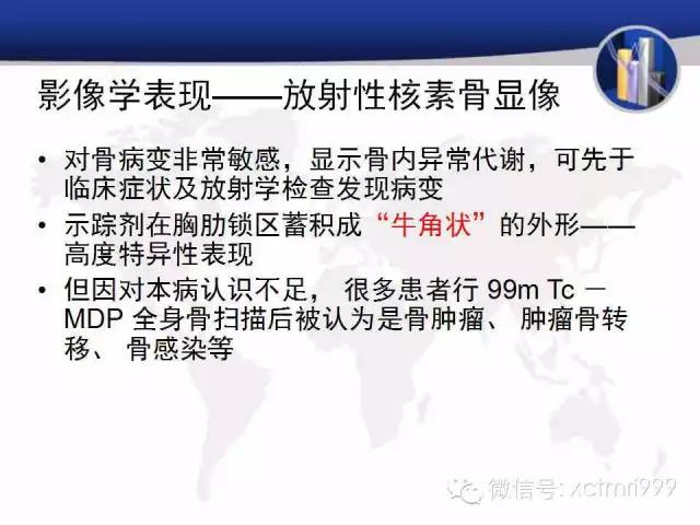 SAPHO综合征 SAPHO综合征