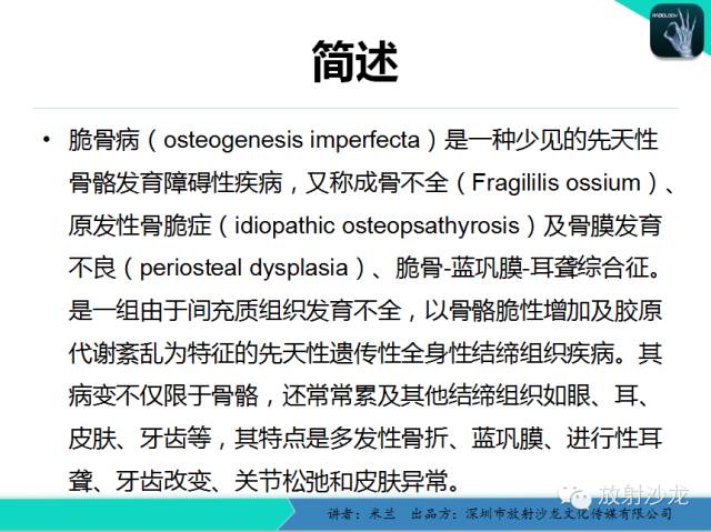 【PPT】脆骨病