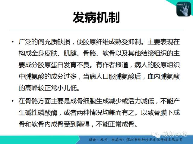 【PPT】脆骨病