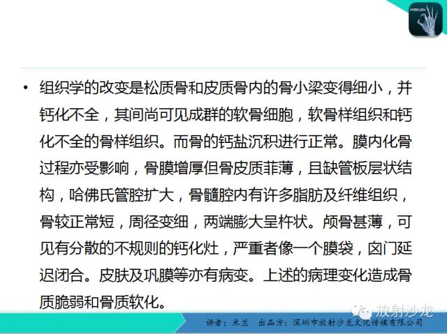 【PPT】脆骨病
