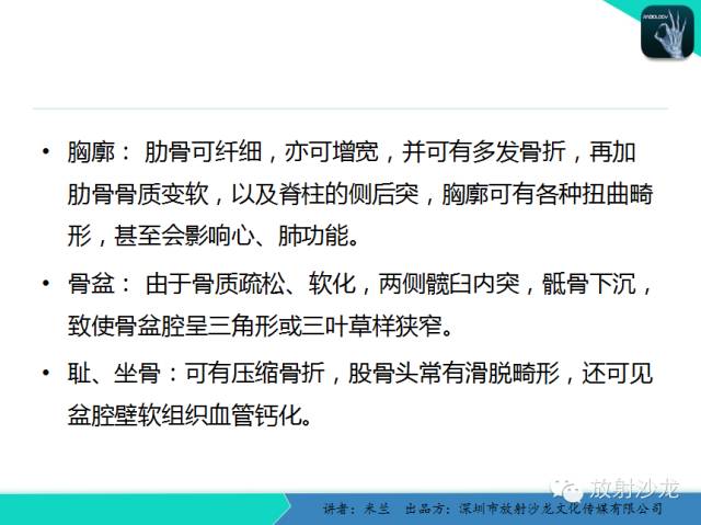 【PPT】脆骨病