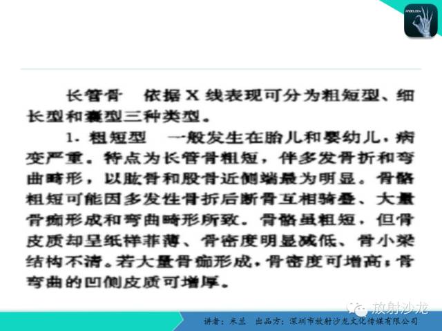 【PPT】脆骨病