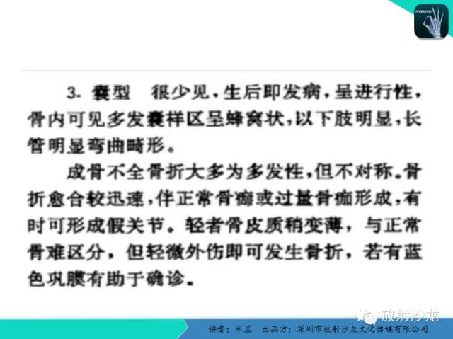 【PPT】脆骨病