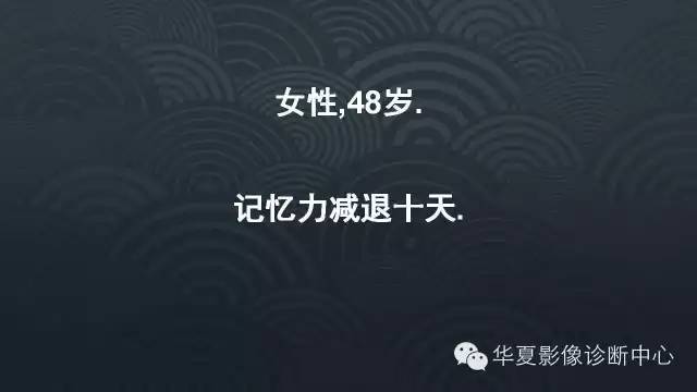 【病例】原发性中枢神经系统淋巴瘤1例MR影像表现