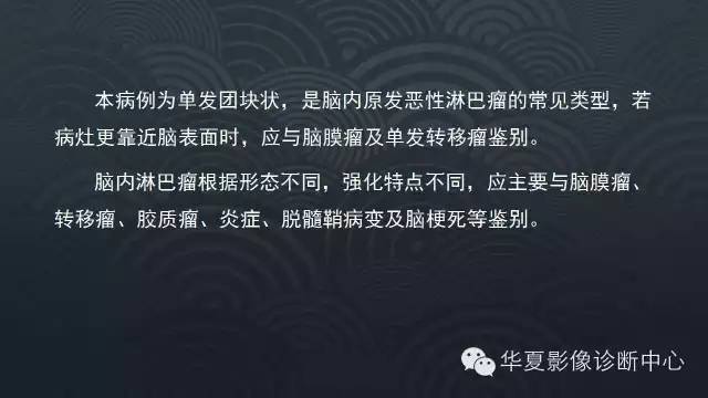 【病例】原发性中枢神经系统淋巴瘤1例MR影像表现