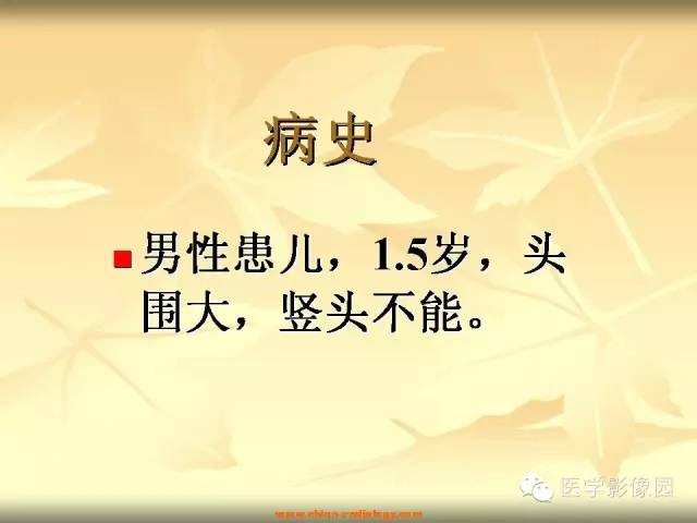 【病例】促纤维增生性星形细胞瘤1例CT及MR影像表现