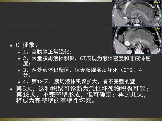 【PPT】急性胰腺炎亚特兰大分类2012年修订版