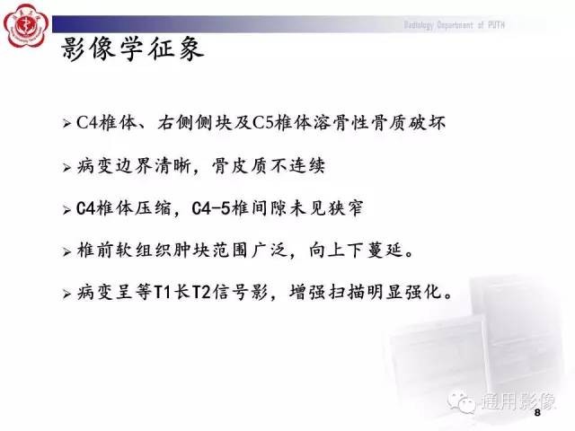 【病例】颈椎嗜酸性肉芽肿1例CT及MR影像表现