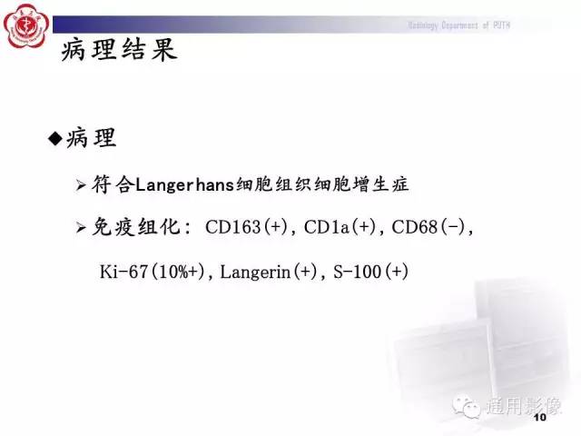 【病例】颈椎嗜酸性肉芽肿1例CT及MR影像表现