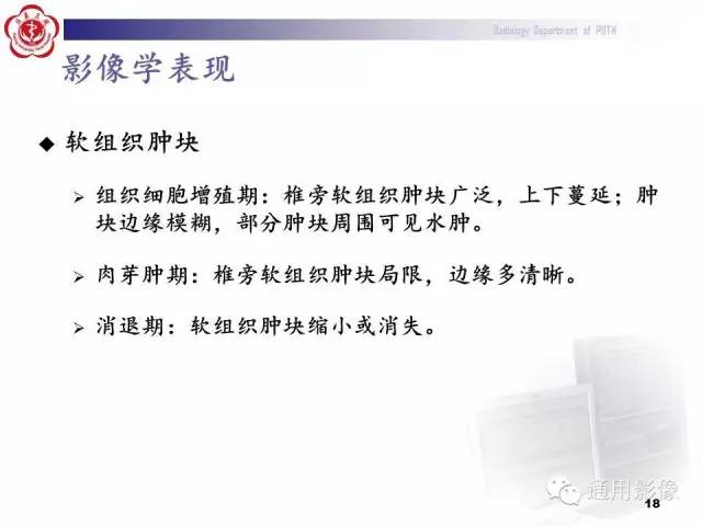 【病例】颈椎嗜酸性肉芽肿1例CT及MR影像表现
