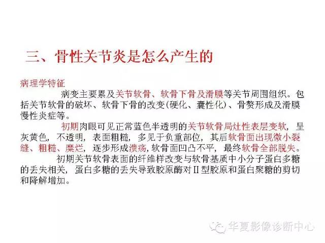 【PPT】深刻理解膝关节骨性关节炎