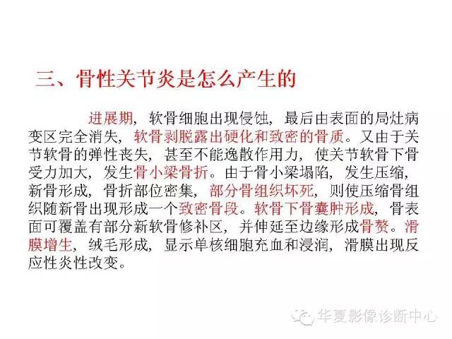 【PPT】深刻理解膝关节骨性关节炎