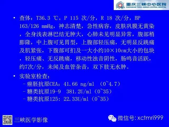【病例】卵巢粘液性囊腺癌1例CT影像表现