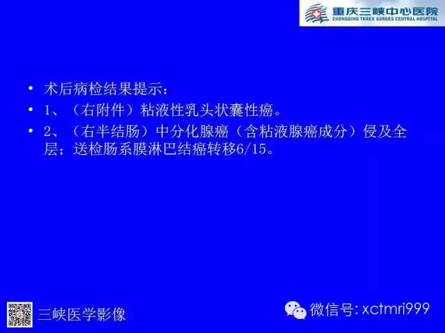 【病例】卵巢粘液性囊腺癌1例CT影像表现