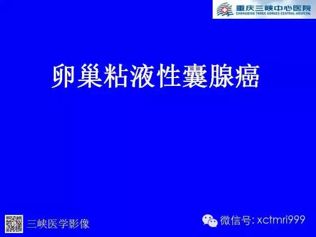 【病例】卵巢粘液性囊腺癌1例CT影像表现