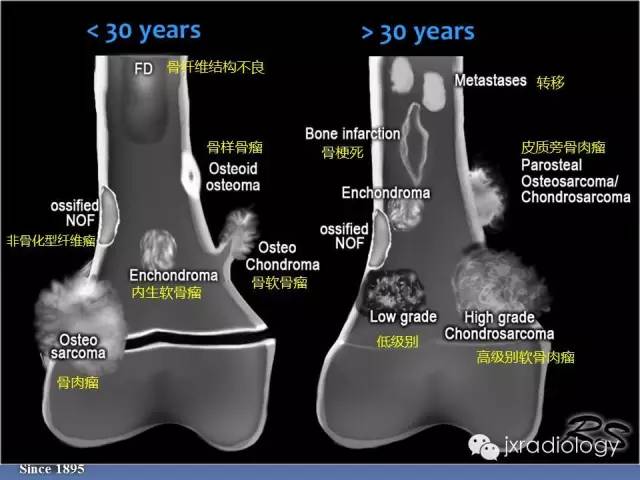 【PPT】硬化性骨肿瘤或肿瘤样病变