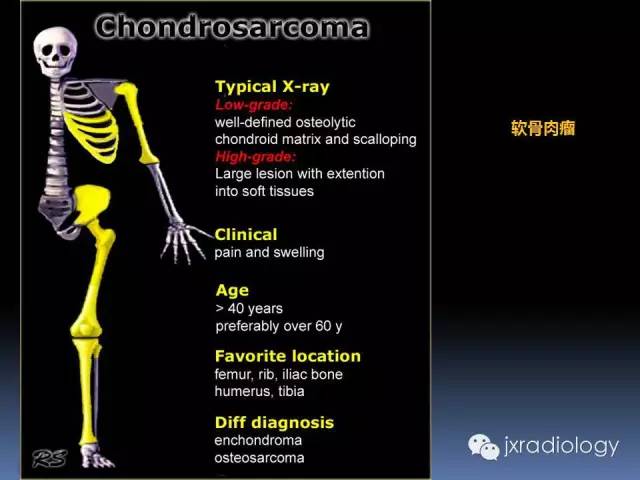 【PPT】硬化性骨肿瘤或肿瘤样病变