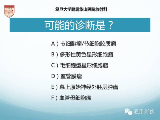 【病例】幕上毛细胞型星形细胞瘤1例MR影像表现