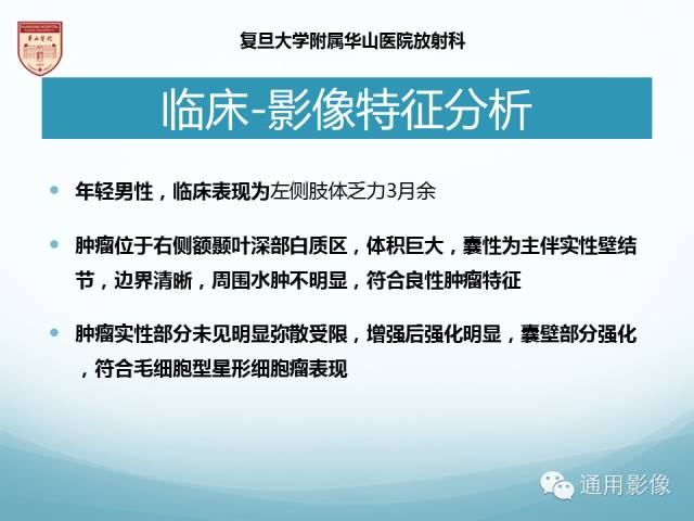 【病例】幕上毛细胞型星形细胞瘤1例MR影像表现