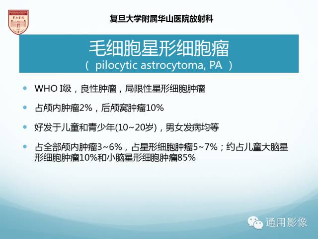 【病例】幕上毛细胞型星形细胞瘤1例MR影像表现