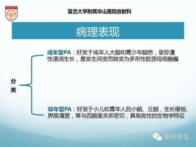 【病例】幕上毛细胞型星形细胞瘤1例MR影像表现