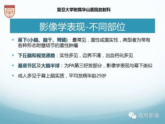 【病例】幕上毛细胞型星形细胞瘤1例MR影像表现