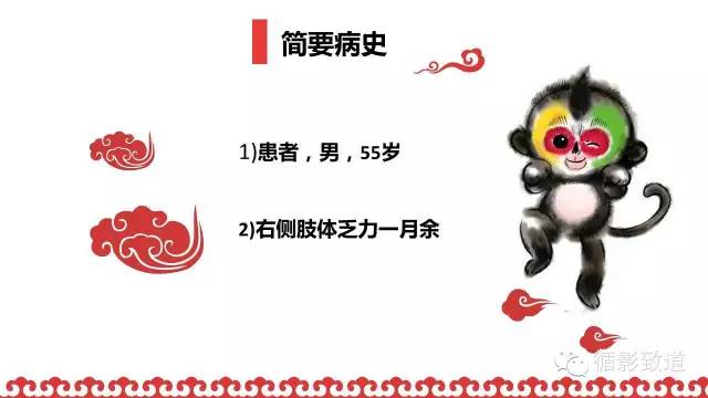 【病例】肿瘤样脱髓鞘1例MR影像表现