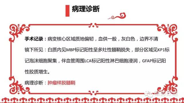 【病例】肿瘤样脱髓鞘1例MR影像表现