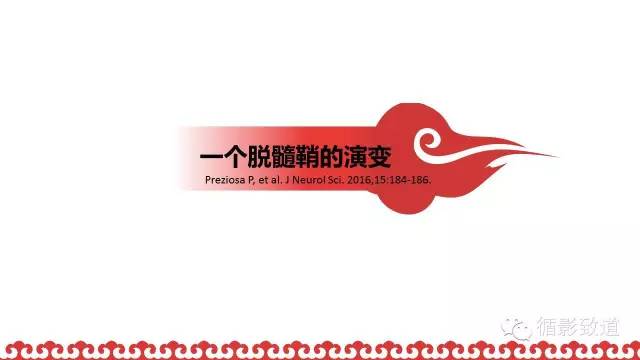 【病例】肿瘤样脱髓鞘1例MR影像表现