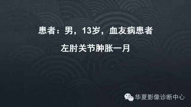 【病例】血友病性关节炎伴假囊肿形成1例X线影像表现