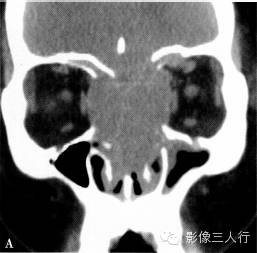 自动草稿