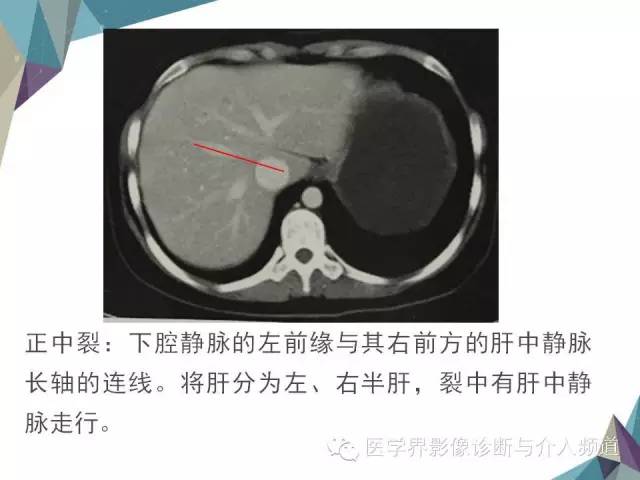 【PPT】肝脏影像学分段