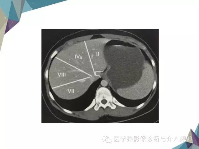【PPT】肝脏影像学分段