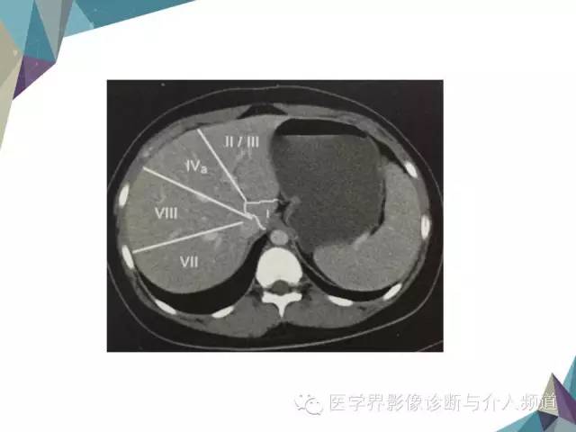 【PPT】肝脏影像学分段