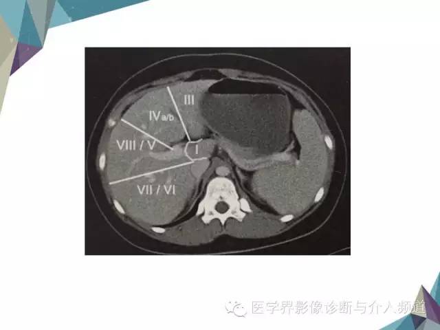 【PPT】肝脏影像学分段