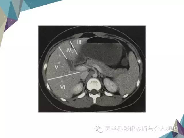 【PPT】肝脏影像学分段