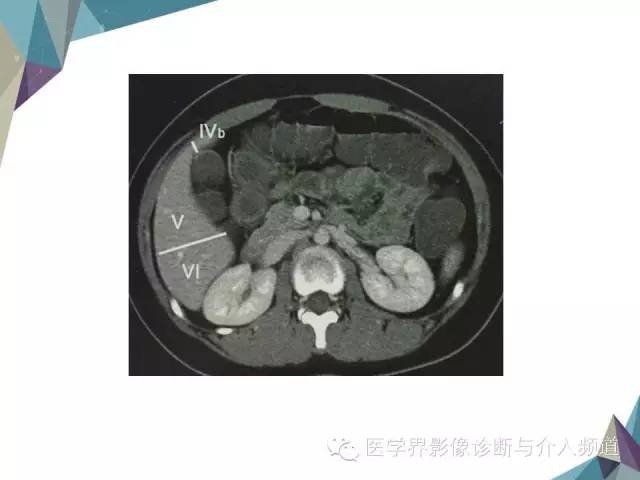 【PPT】肝脏影像学分段