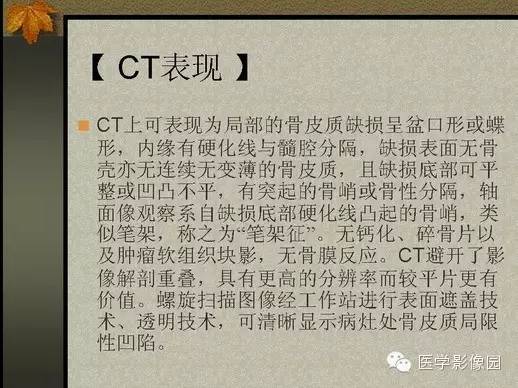 【PPT】纤维骨皮质缺损的影像诊断