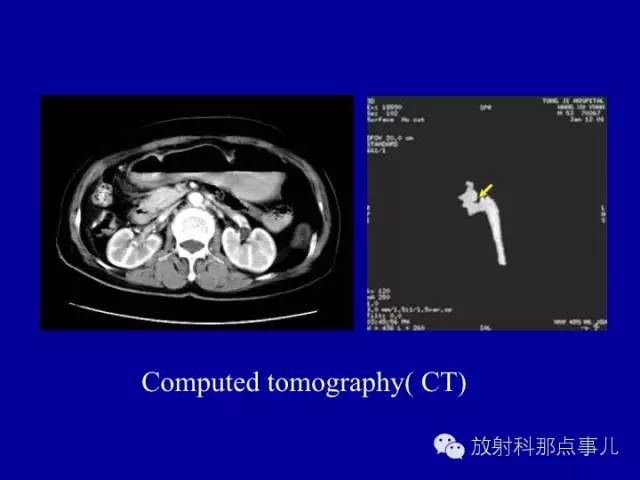 【PPT】泌尿系统常见疾病的影像学诊断