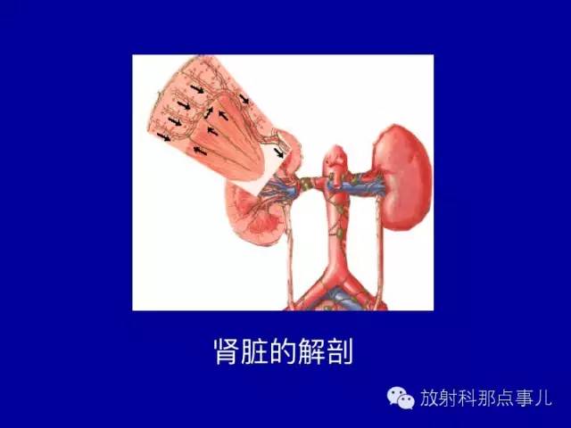 【PPT】泌尿系统常见疾病的影像学诊断