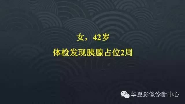 【病例】胰尾副脾1例CT及MR影像表现