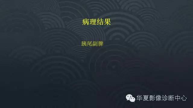 【病例】胰尾副脾1例CT及MR影像表现